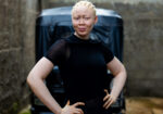 Daniella Garrick Set to Represent Sierra Leone at Mr. & Miss Albinism Africa 2025