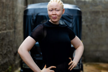 Daniella Garrick Set to Represent Sierra Leone at Mr. & Miss Albinism Africa 2025